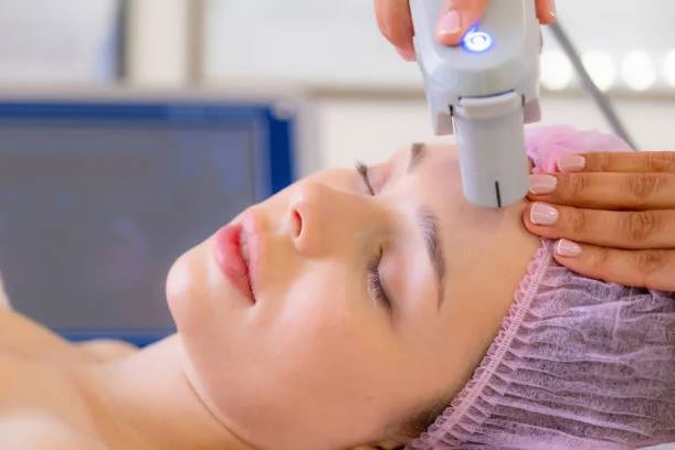 Exploring Effective Laser Therapies for Skin